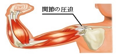 肩関節の圧迫